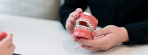 METAL BRACES