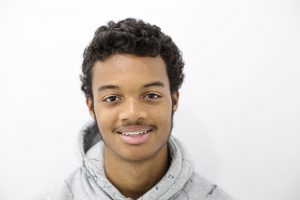 braces with metal