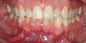 case 4 before