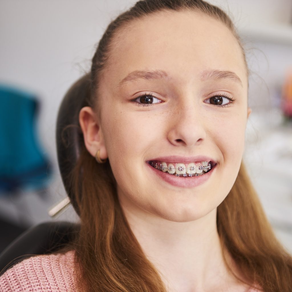 traditional braces treatment