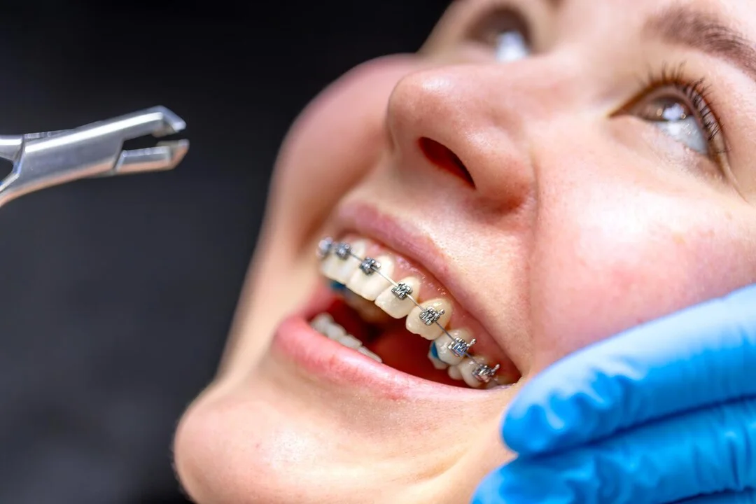 Modern Orthodontic Treatment in Australia