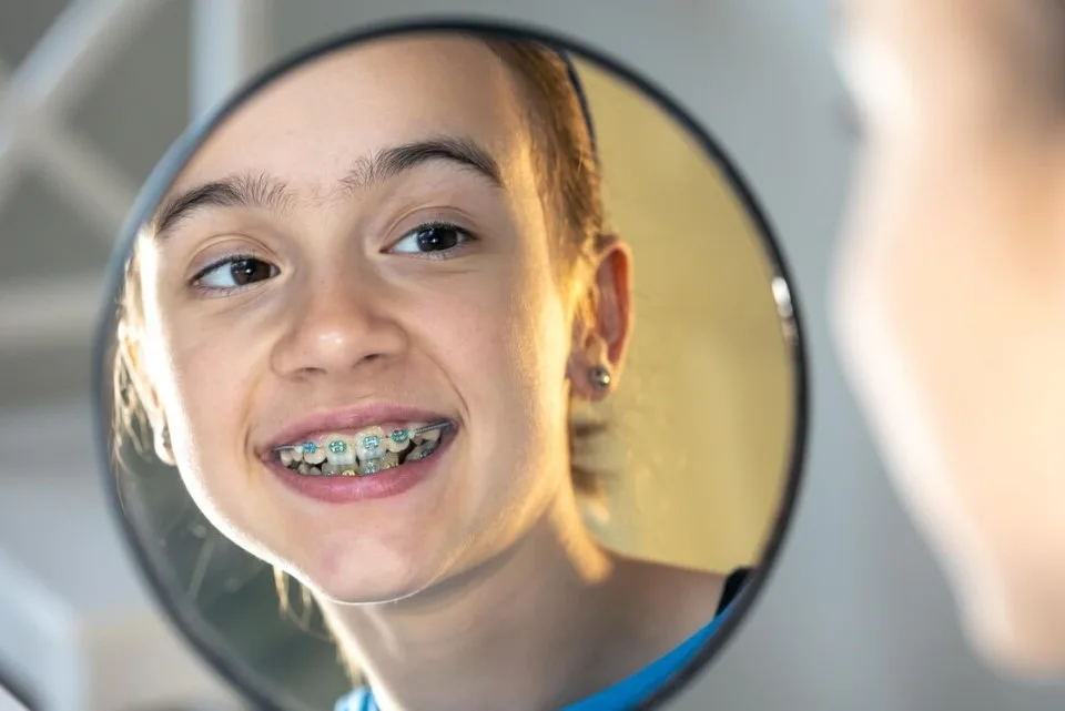 Orthodontic Treatment in Australia