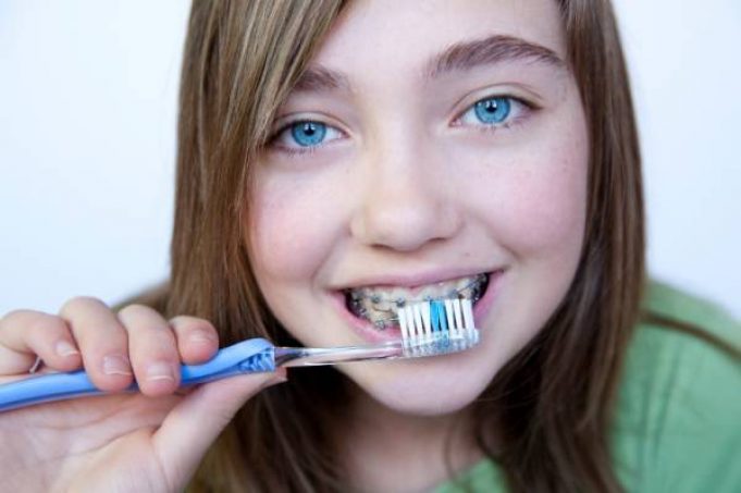 Looking after your teeth and gums during orthodontic treatment