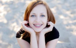 Are there any Side Effects to Wearing Braces?