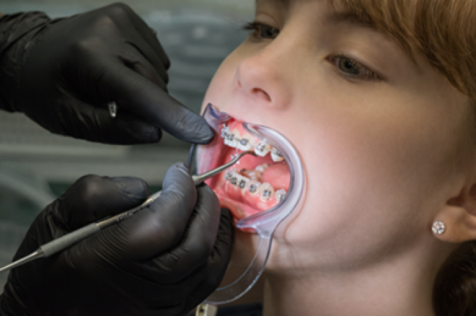 Everything You Need to Know About Modern Orthodontic Options