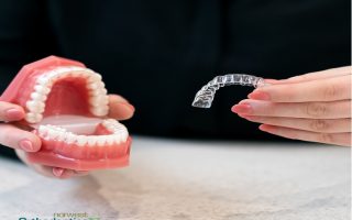 Adult Orthodontics: It’s Never Too Late for a Great Smile