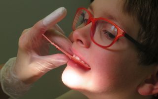 What orthodontic issues benefit from early intervention?