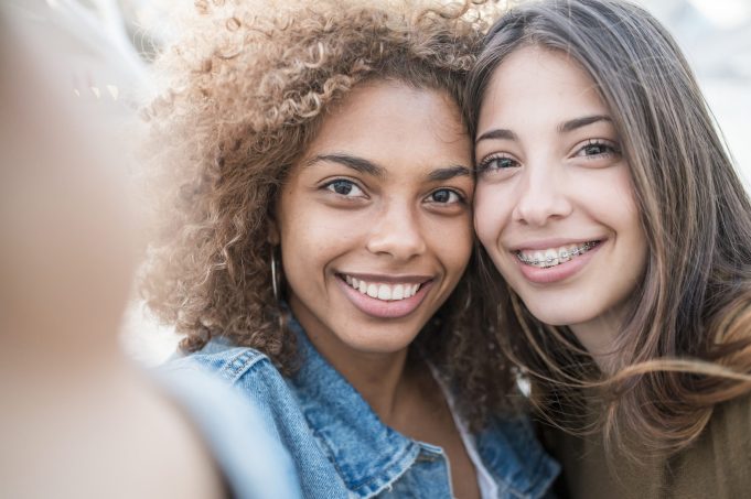 Braces Before and After: Real Patient Results That Inspire Your Smile Transformation