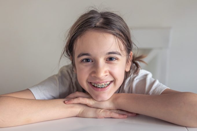 How Much Do Braces Cost in Australia? Everything You Need to Know 