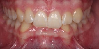 orthodontist in sydney