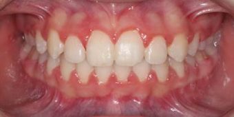orthodontist in sydney