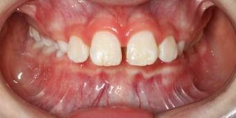 Orthodontist in Sydney