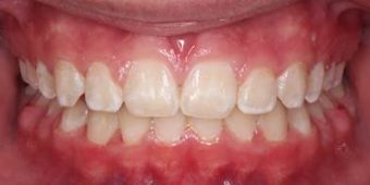 Orthodontist in Sydney