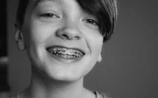Which orthodontic treatment is fastest?