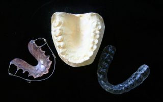 Orthodontic terms explained