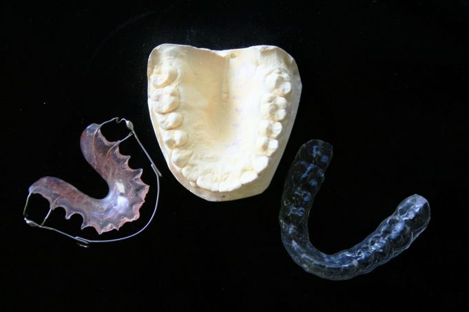 Five fun facts about orthodontics