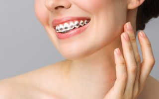 Caring for Your Braces: Tips for Proper Oral Hygiene