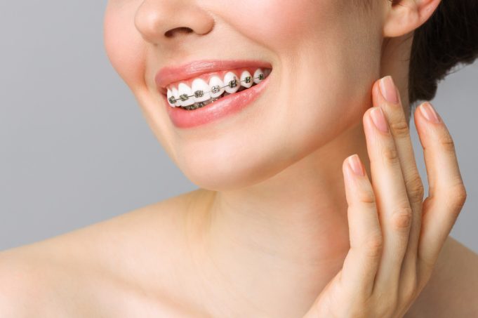 Caring for Your Braces: Tips for Proper Oral Hygiene