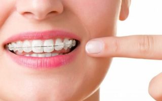 The orthodontic process in six simple steps