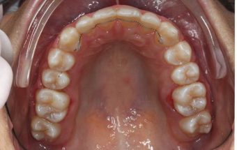 orthodontist in Sydney