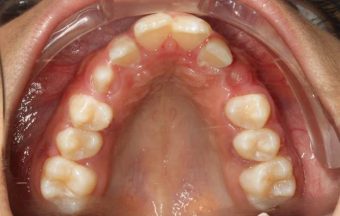 orthodontist in Sydney